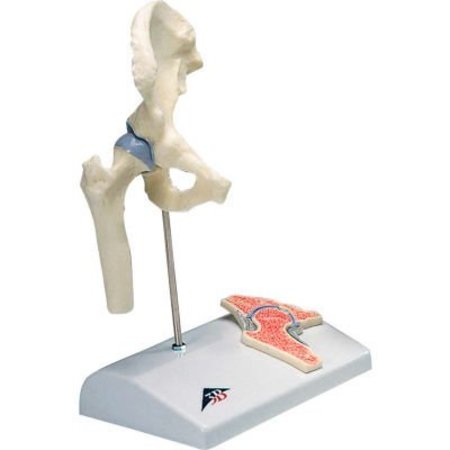 FABRICATION ENTERPRISES 3B® Anatomical Model - Mini Hip Joint with Cross Section of Bone on Base 956176